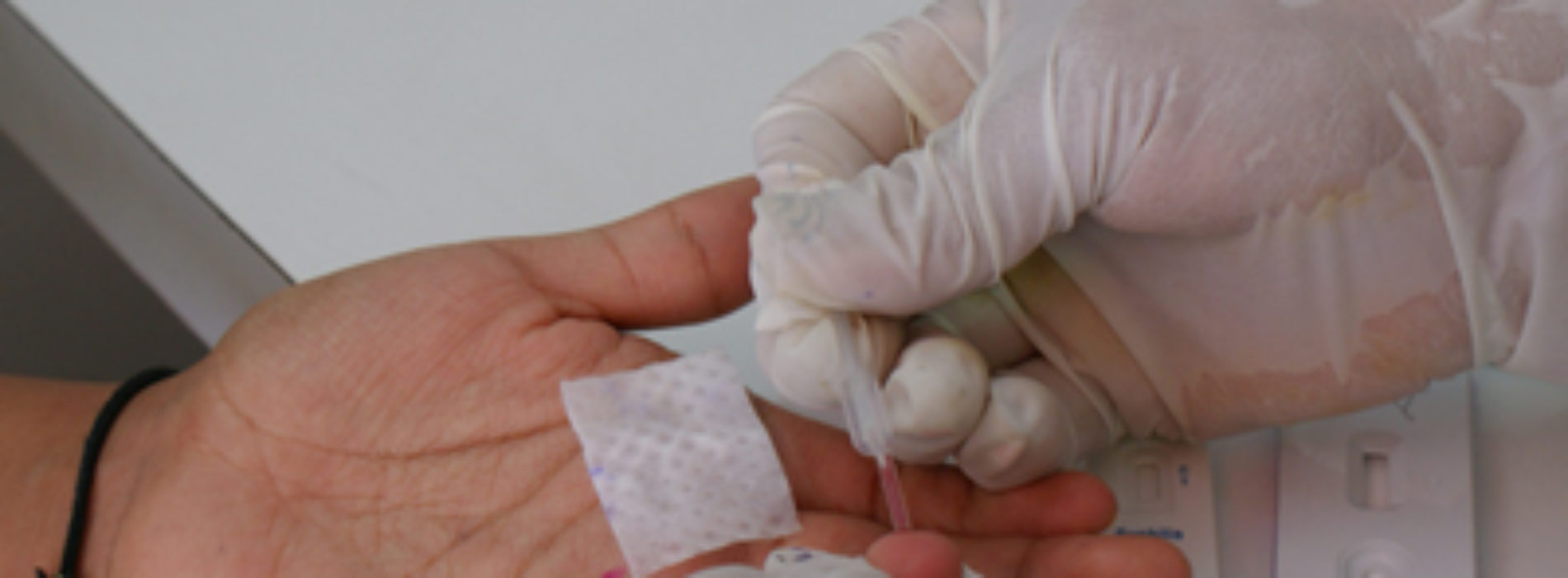 Promueven COESIDA y UABJO la prueba rápida para la detección del VIH y la Sífilis