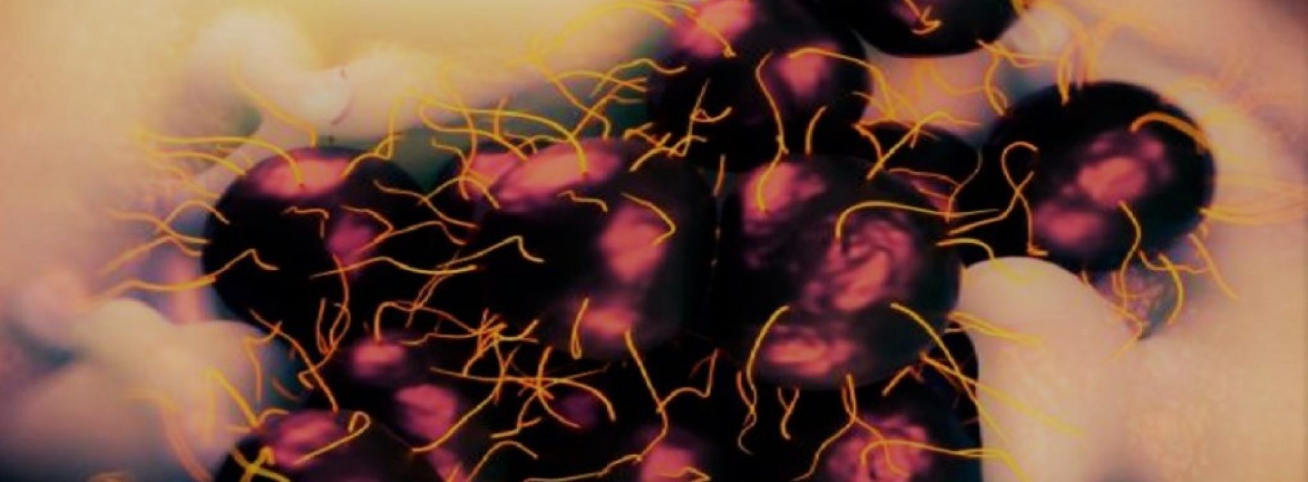 Gonorrea: Advierten por la nueva cepa de ETS imposible de curar