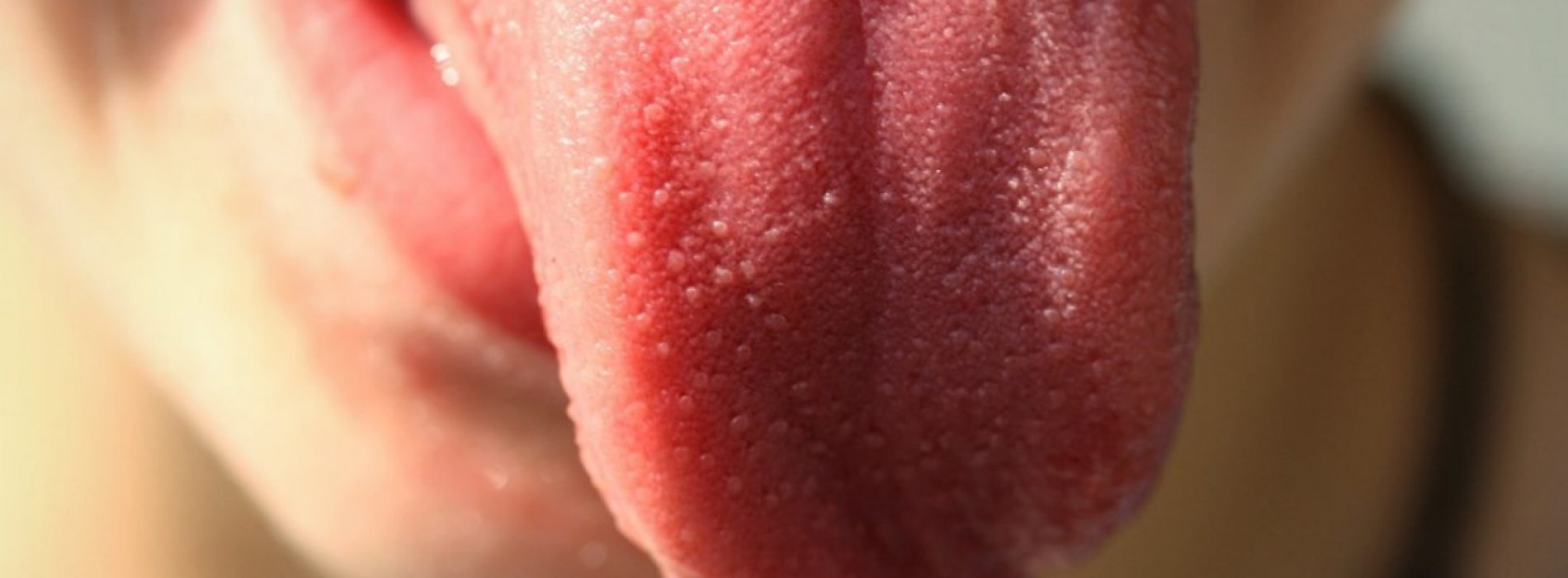 Prueba de saliva permite saber si tienes el Virus del Papiloma Humano