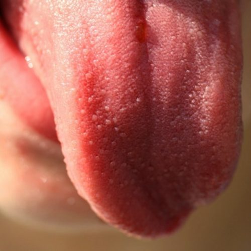 Prueba de saliva permite saber si tienes el Virus del Papiloma Humano